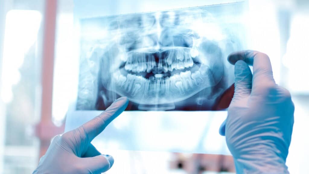 radiologia odontologica